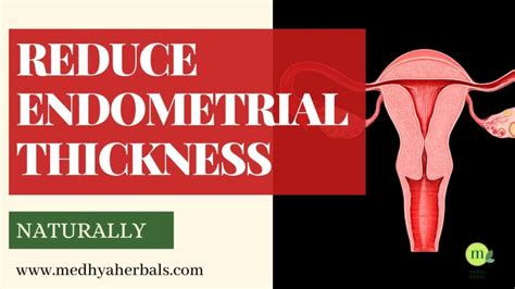 And Last, but certainly not least Endometrial carcinoma. . How to reduce endometrial thickness naturally